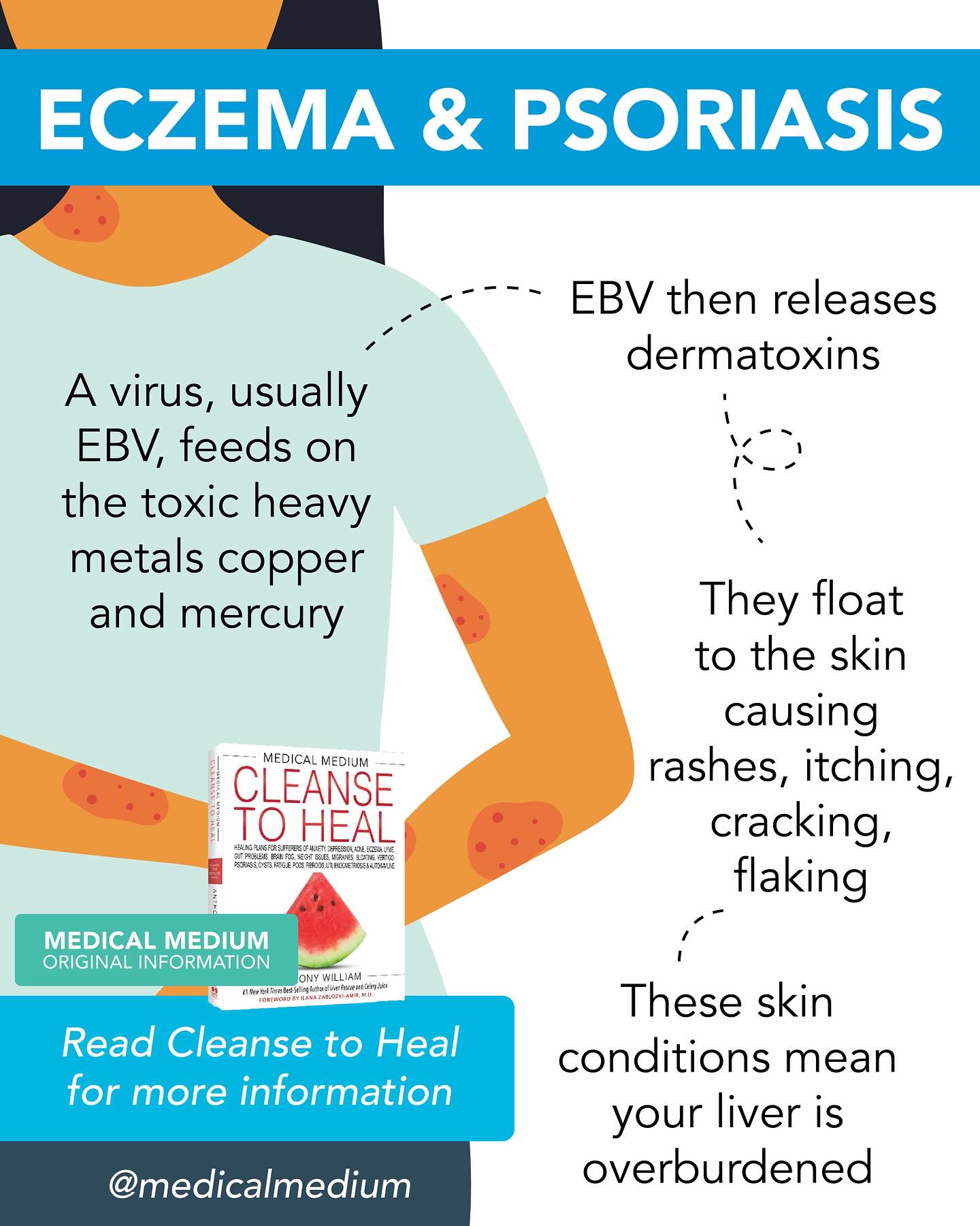 Medical - Eczema & Psoriasis Eczema and psoriasis occur due to a ...