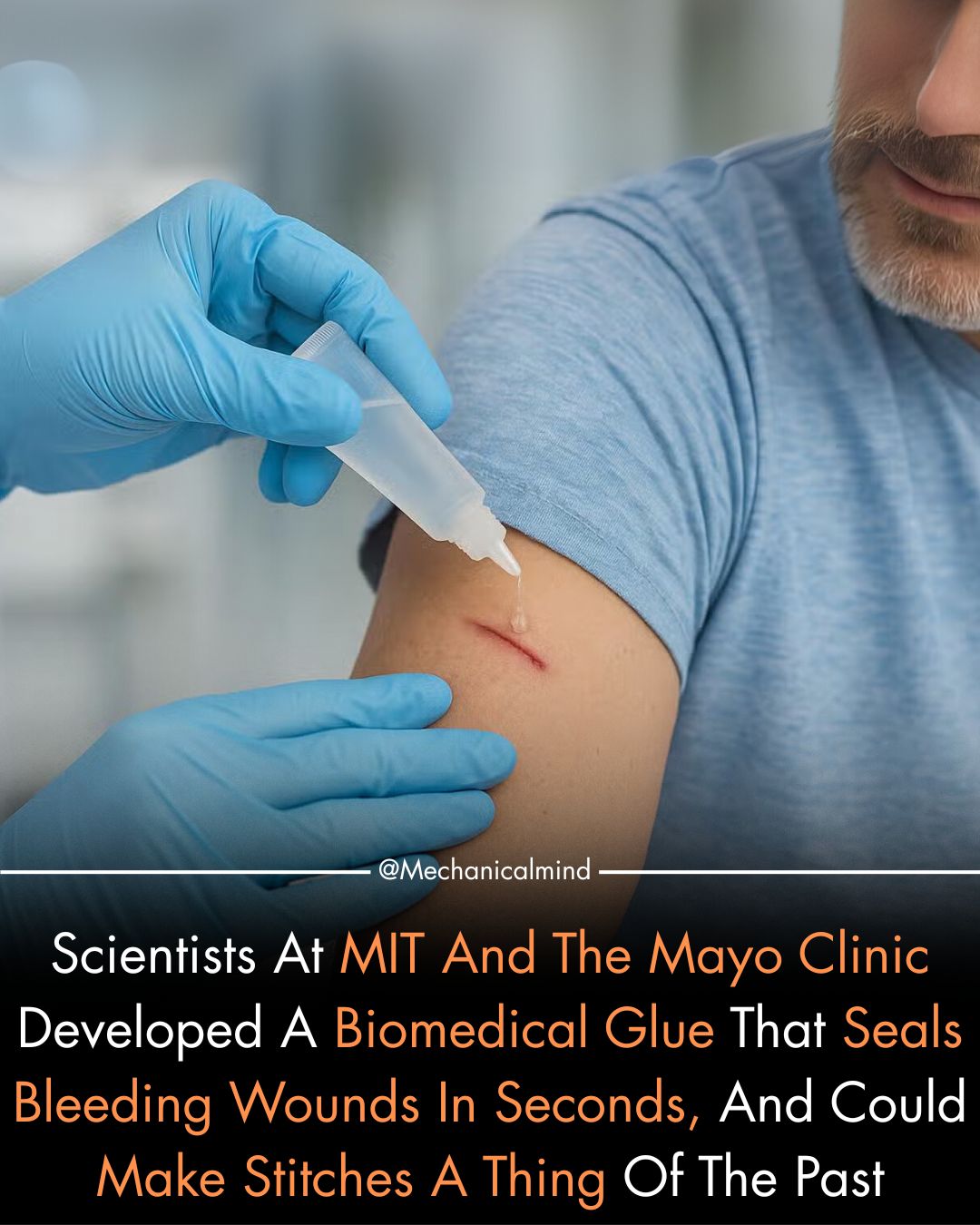 Mechanical - A groundbreaking collaboration between MIT and the Mayo ...