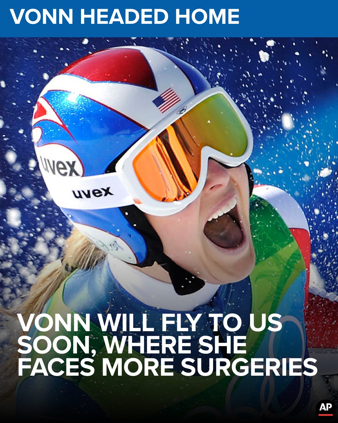 WTHR-TV - The skiing superstar will face more leg... | Facebook