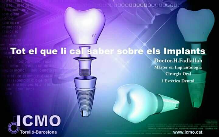 ICMO - PREGUNTES FREQÜENTS Puc patir rebuig? Els implants estan fets de ...