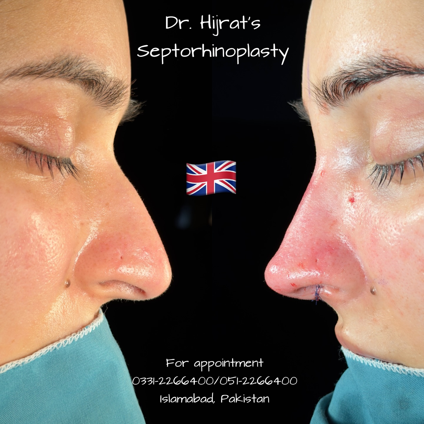 Dr. Hijrat Aesthetic Plastic Surgery & Hair Transplant Clinic Islamabad ...