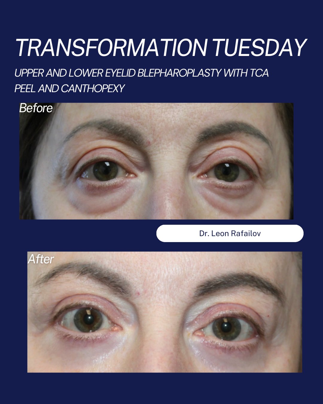 SightMD - Check out this stunning before & after! This... | Facebook