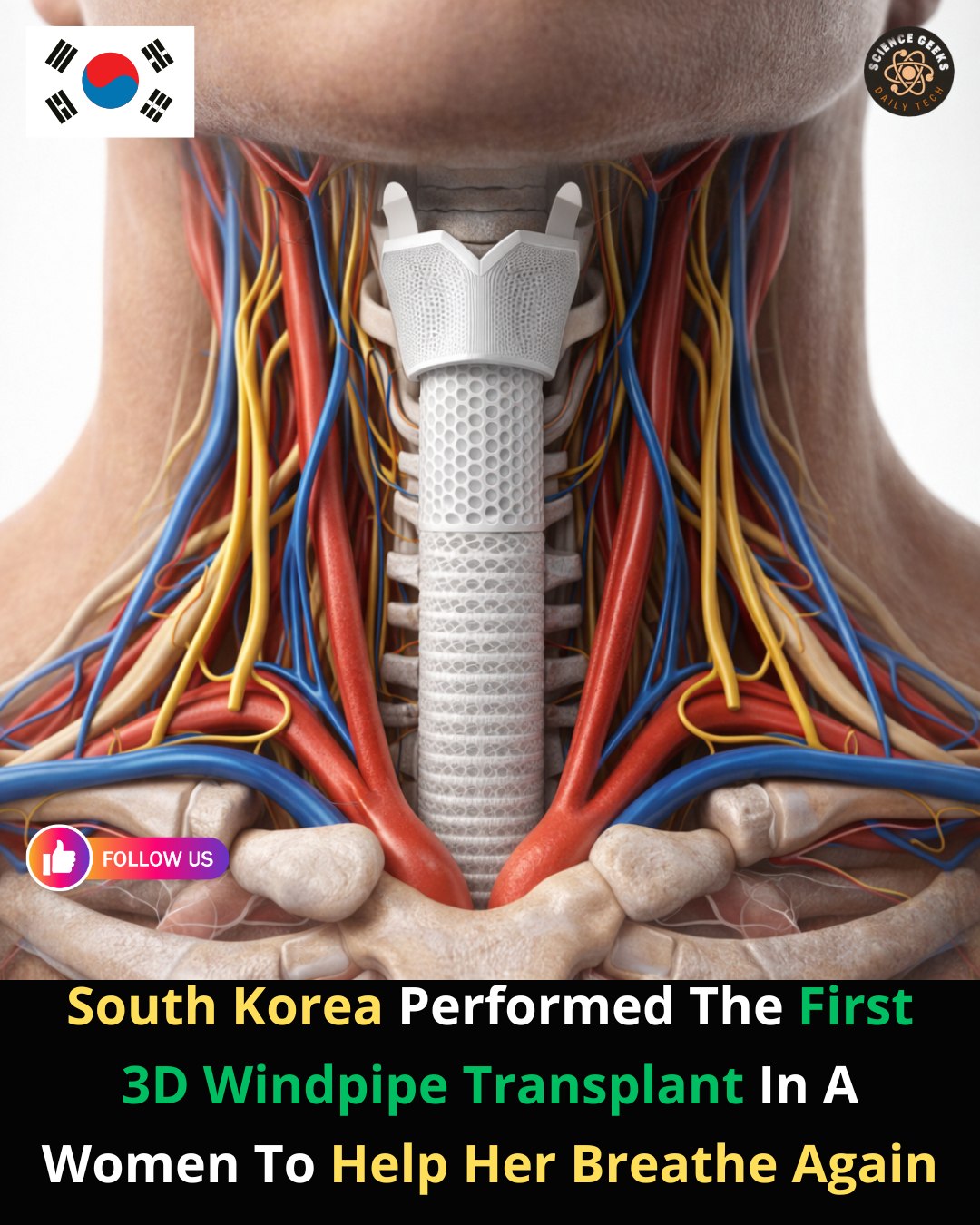 TruthBytes - South Korean surgeons have successfully implanted what’s ...