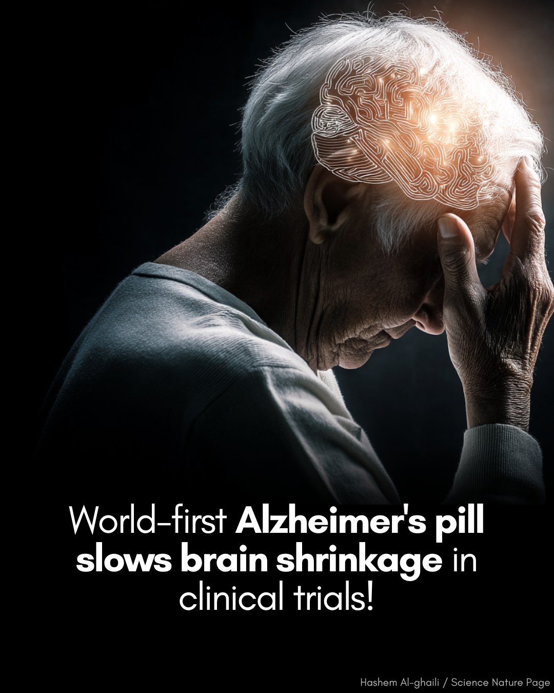 Hashem - 🧠 Scientists created a a daily pill that slows brain atrophy ...