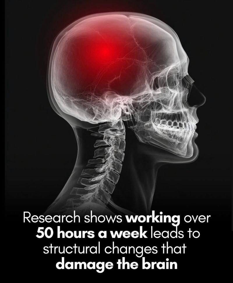 Health - New research finds overworking literally reshapes the brain ...
