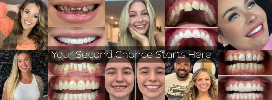 Smile Again Dental - Texas (@smileagaintexas) - Mentions | Facebook