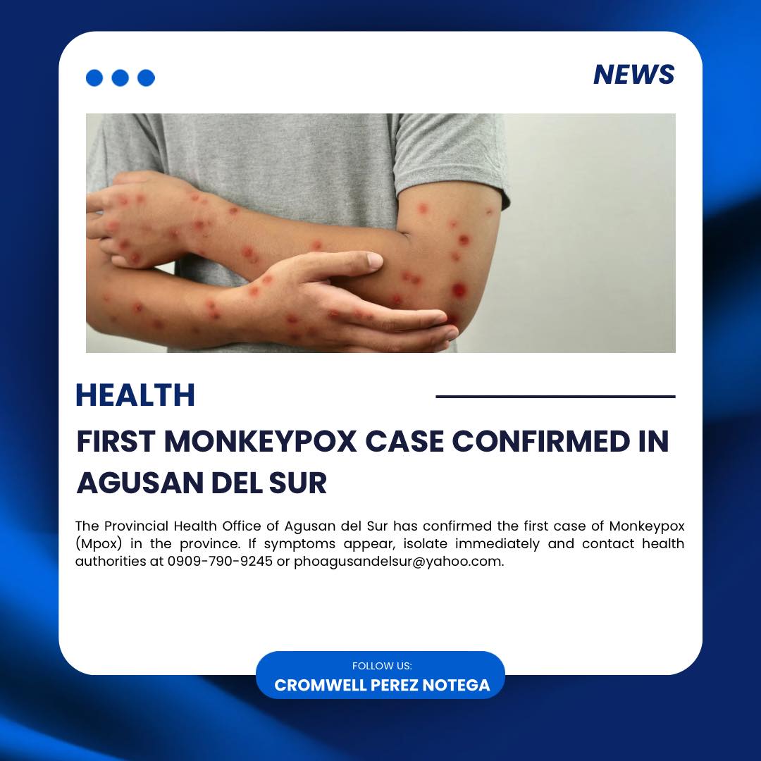 🦠 FIRST MONKEYPOX CASE CONFIRMED... - Cromwell Perez Nortega | Facebook