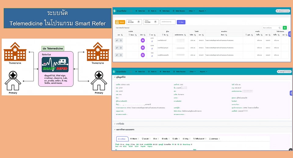 Smart Refer - โปรแกรม Smart Refer พัฒนาเพิ่มระบบ 