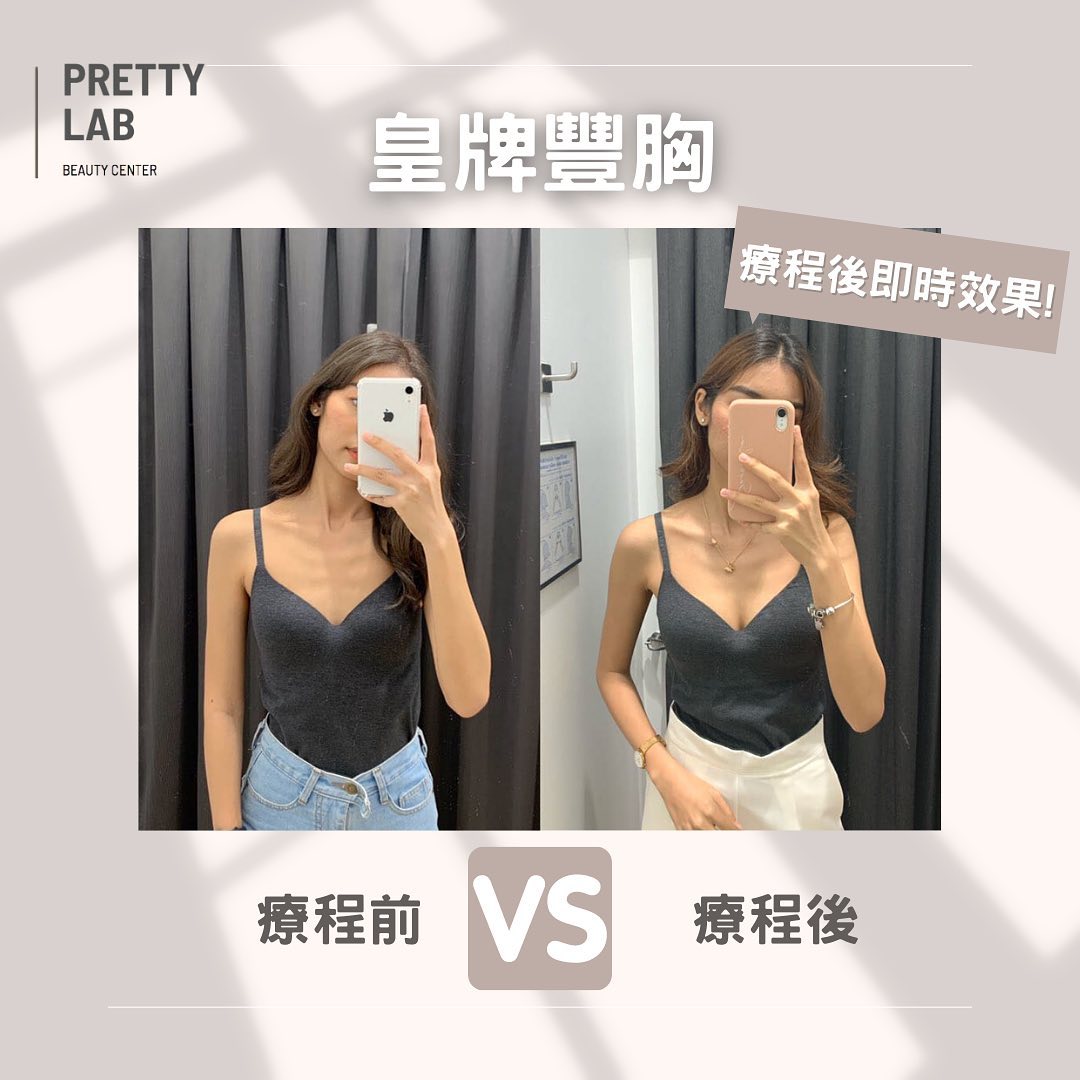 Pretty Lab - 🌟改善胸部問題 | 不影響生育🌟 嚴選高純度且安全原料 獨家生產技術 只需30-60分鐘... | Facebook