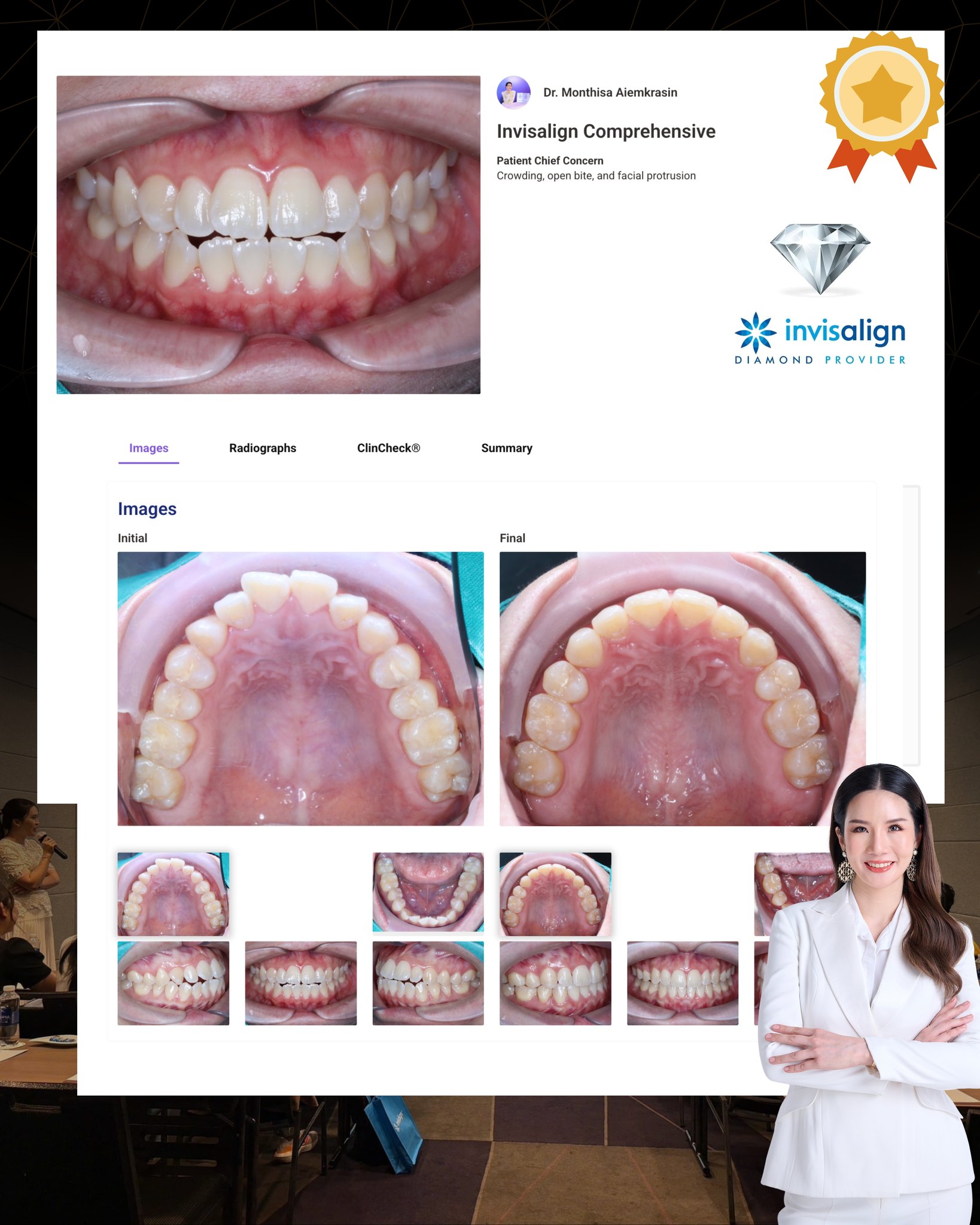 Dente... - Dente Align Clinic - Invisalign Diamond Provider