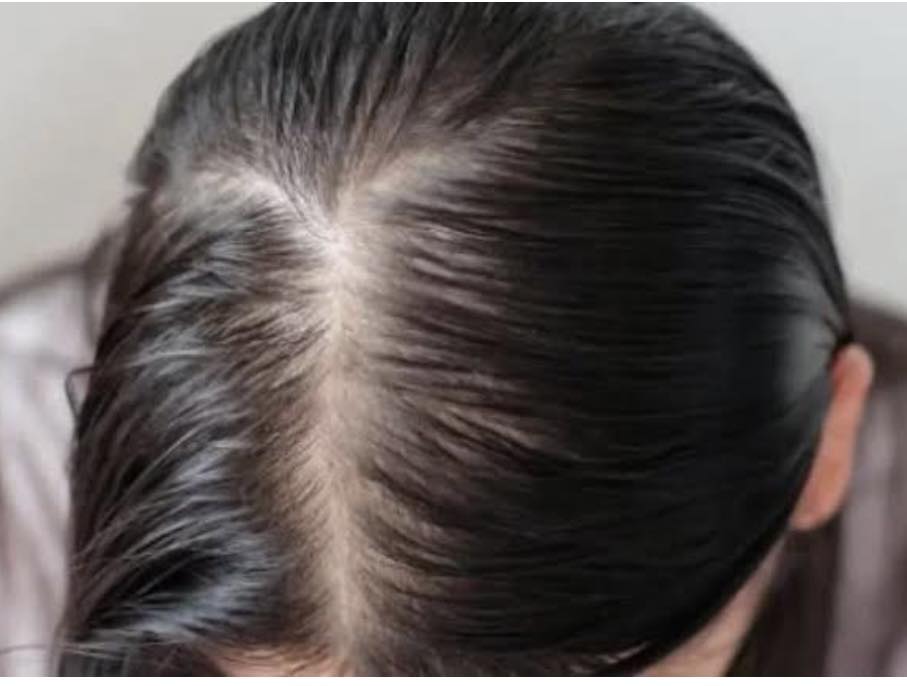 ghk-cu grey hair does copper peptide work for gray Private Label Oem AHK-Cu GHK-Cu