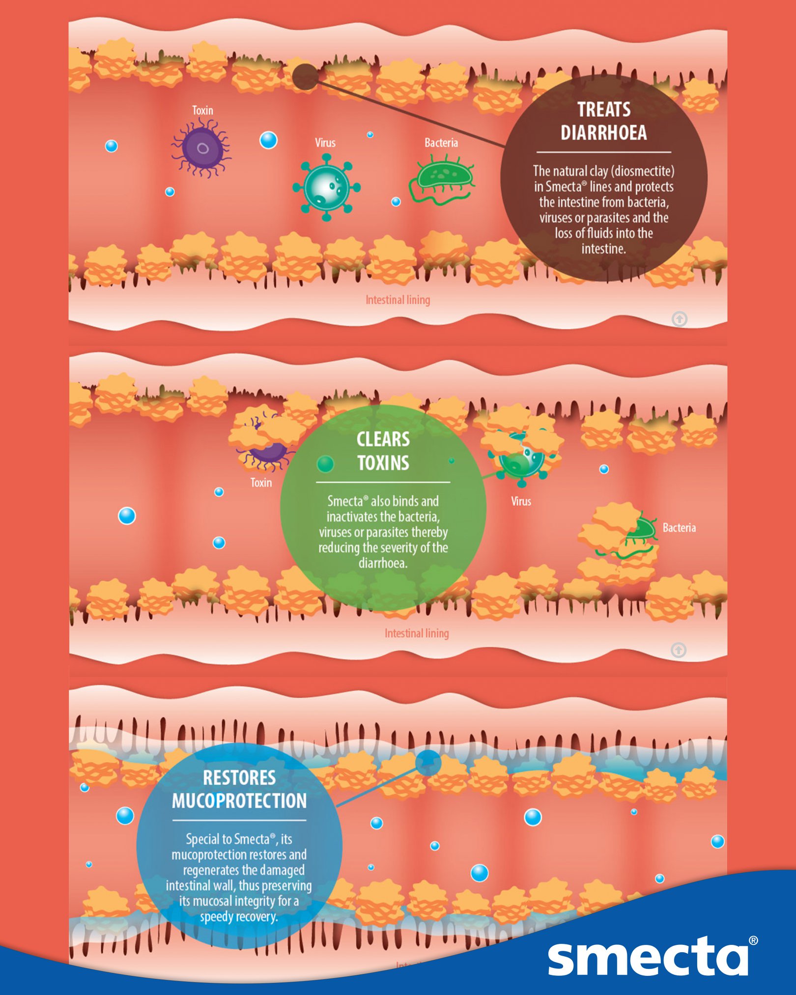 Here's an infographic of how Smecta... - Smecta South Africa | Facebook