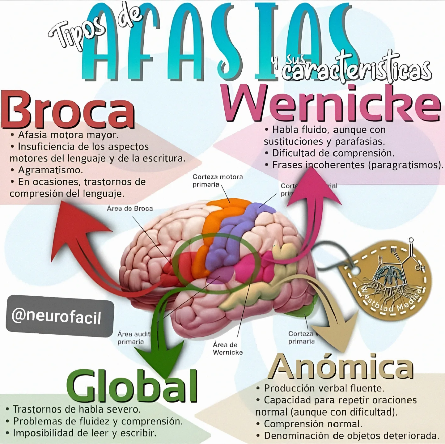 NeuroFacil - ¿Qué tipos de afasia existen? Hay dos categorías amplias ...