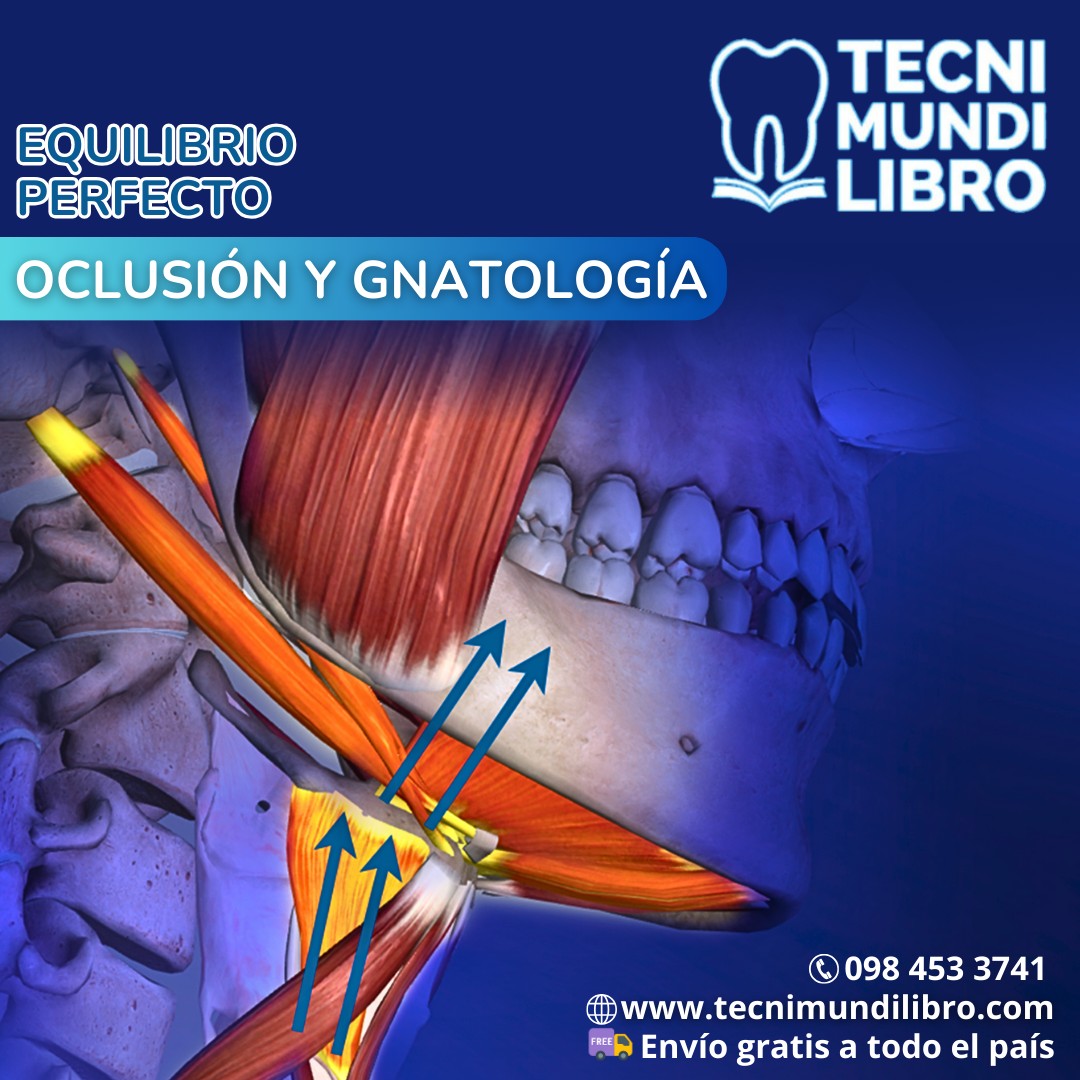 Tecni - ¿Problemas de oclusión en tus pacientes? Entiende el ...