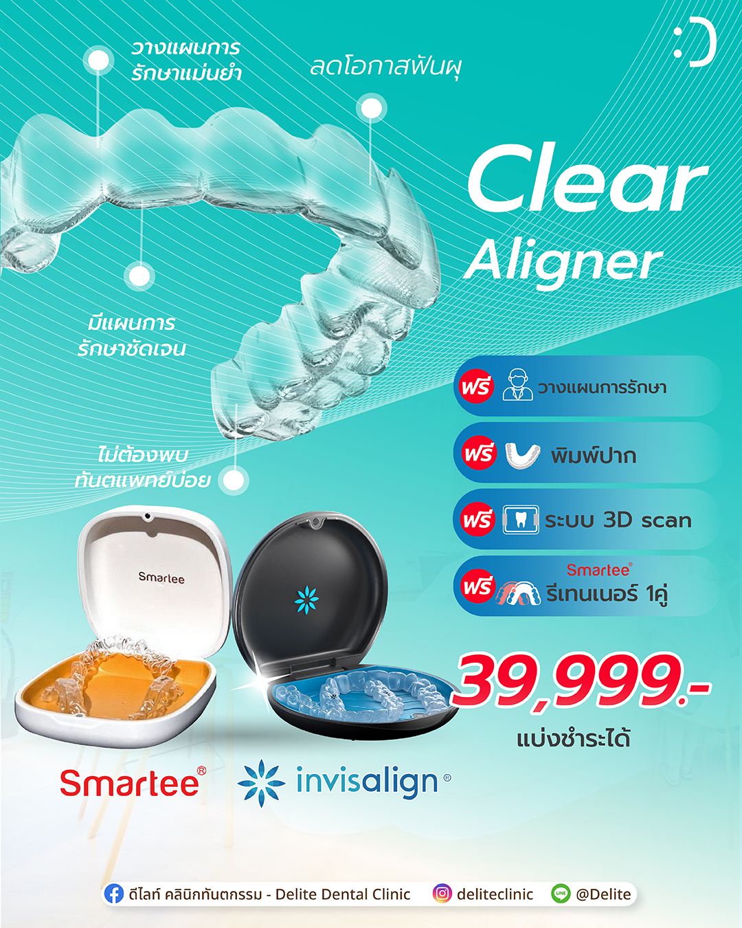 ดีไลท์ - จัดฟันใส ตอบโจทย์ทุกไลฟ์สไตล์‼️ Clear Aligner เริ่มต้น 39,999 ...