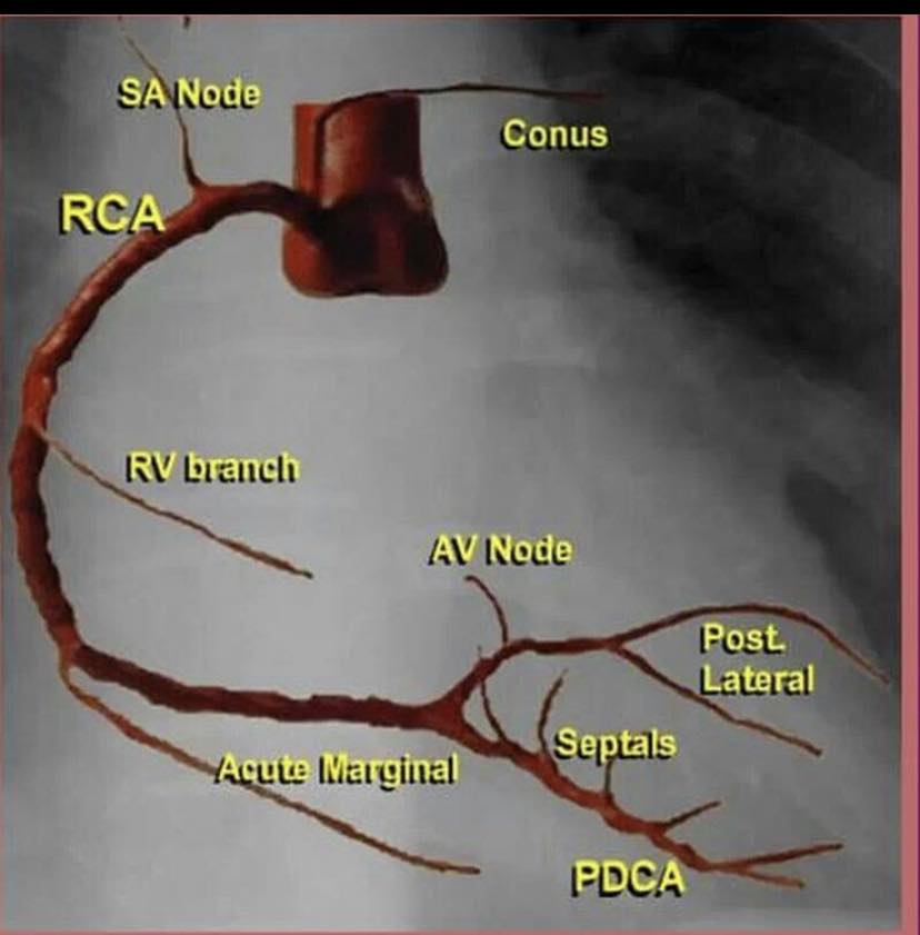 Cardiophilia - RCA branches Look at where SA Node and AV... | Facebook