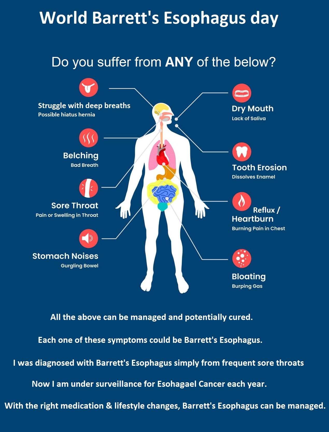 bpc 157 barrett's esophagus 𝗗𝗼 𝗬𝗼𝘂 𝗼𝗿 𝗦𝗼𝗺𝗲𝗼𝗻𝗲 𝗬𝗼𝘂 𝗟𝗼𝘃𝗲 𝗛𝗮𝘃𝗲 𝗕𝗮𝗿𝗿𝗲𝘁𝘁'𝘀 𝗘𝘀𝗼𝗽𝗵𝗮𝗴𝘂𝘀? You may qualify for the SURVENT Study—a national research trial funded by the NIH, designed to find the best way to manage Cats