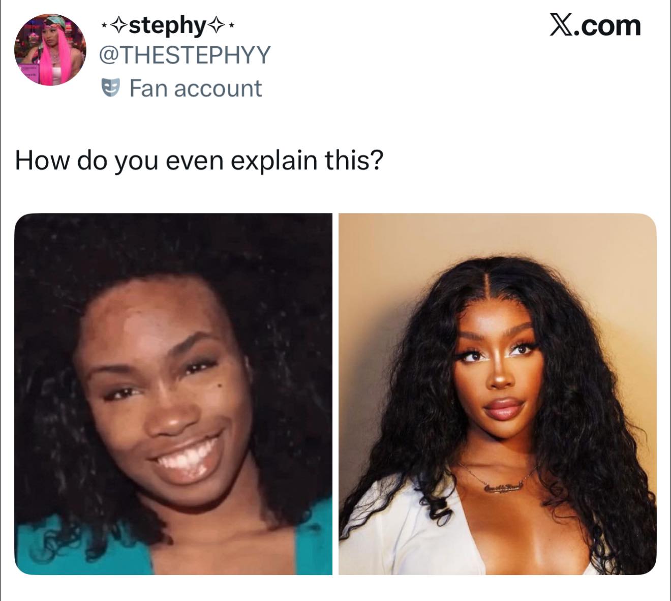 Accusations of skin bleaching are being hurled in SZA's direction again after pills commonly used for skin bleaching appeared in her Instagram stories over the weekend