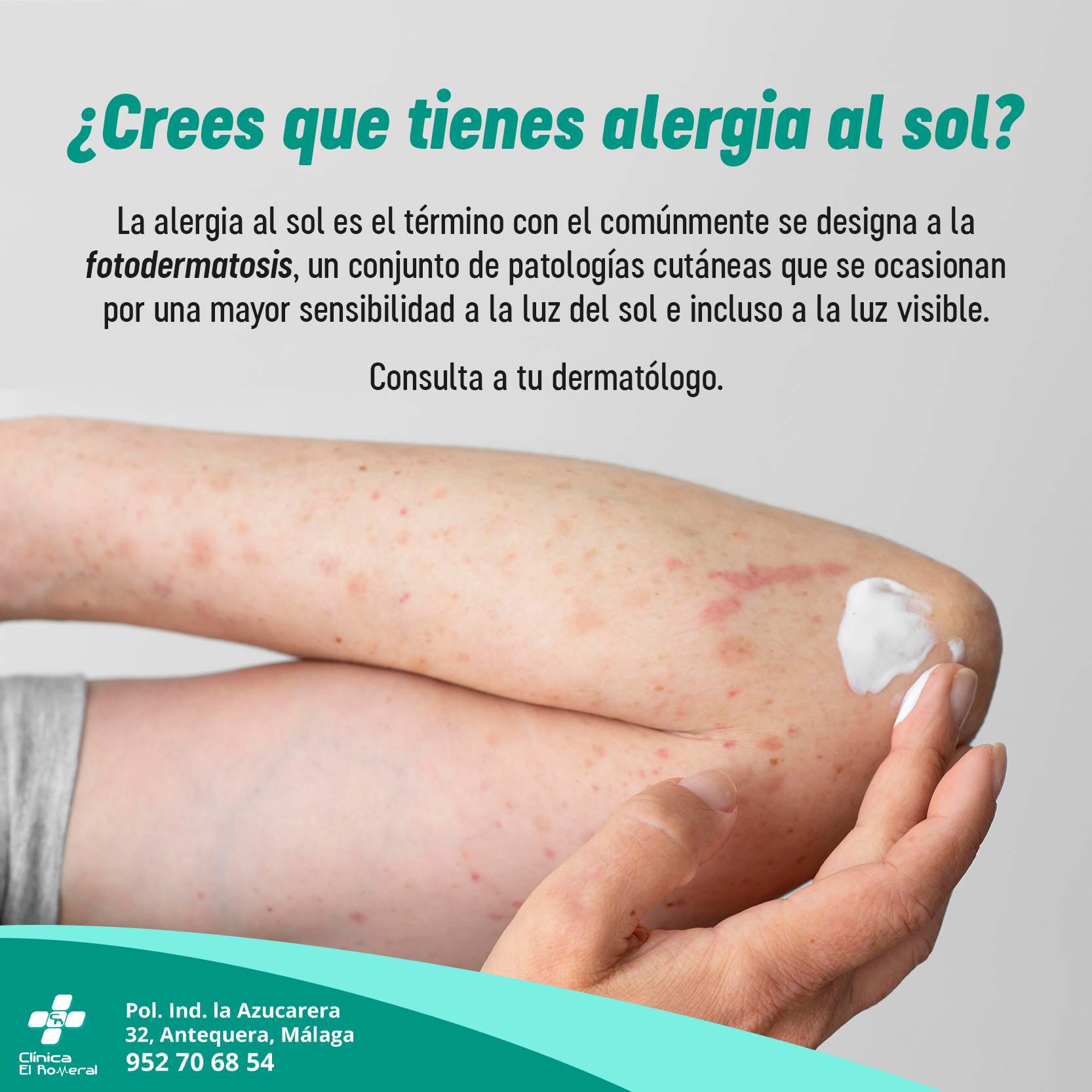 Clínica - ☀️ ¿Crees que tienes alergia al sol? La llamada “alergia al ...