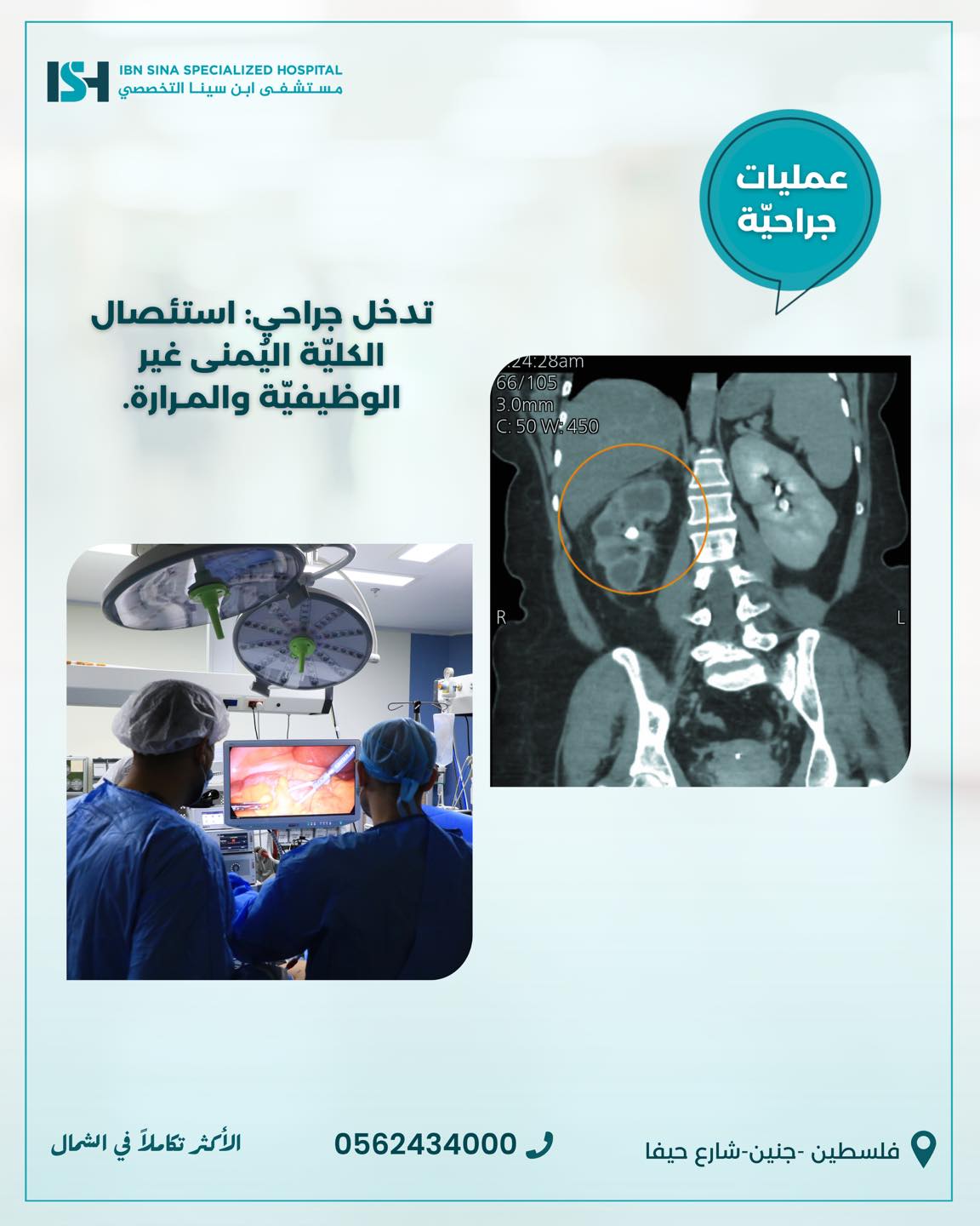 ibn-sina-specialized-hospital