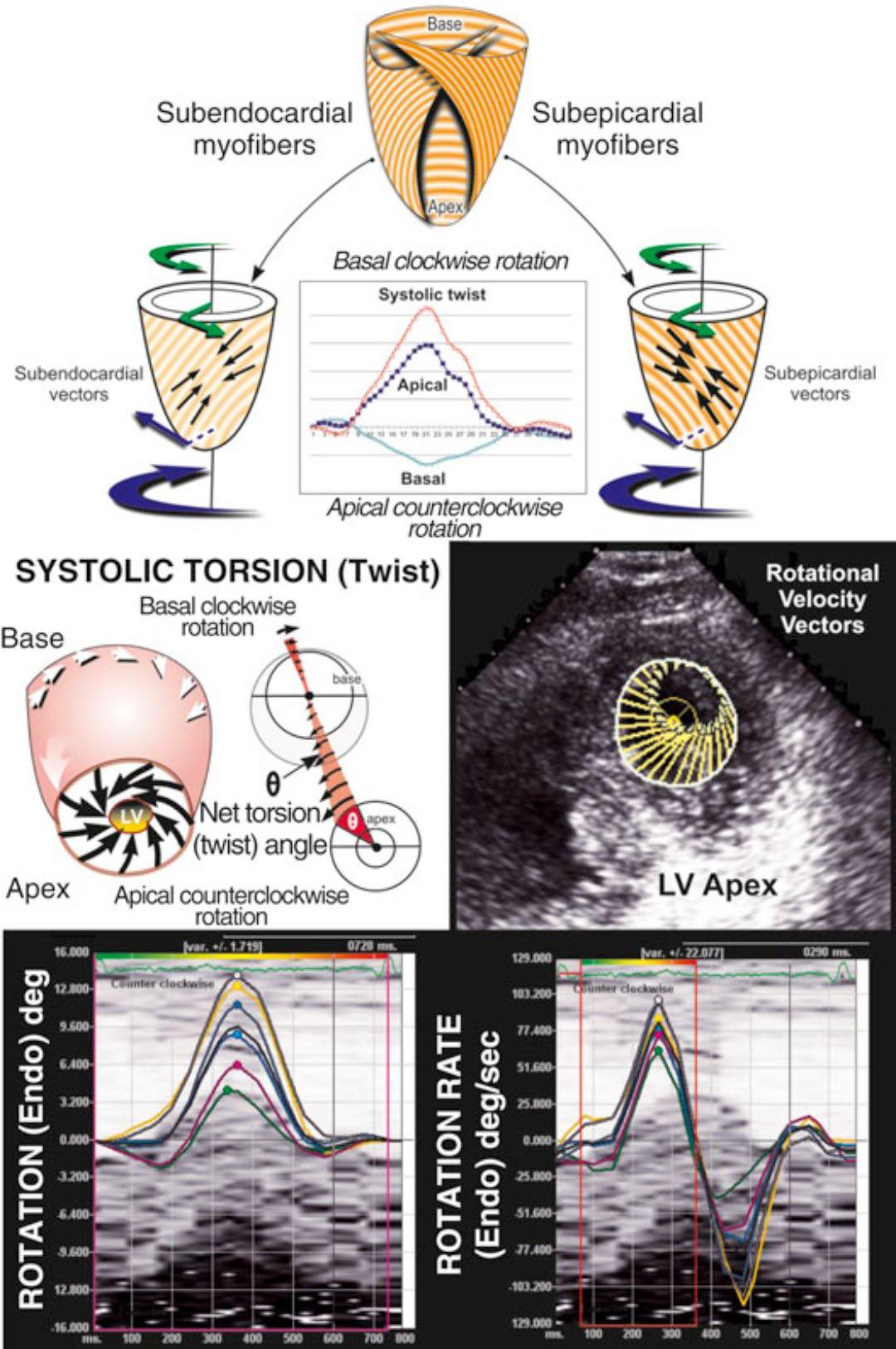 Cardiophilia - What is the most likely reason for complete... | Facebook