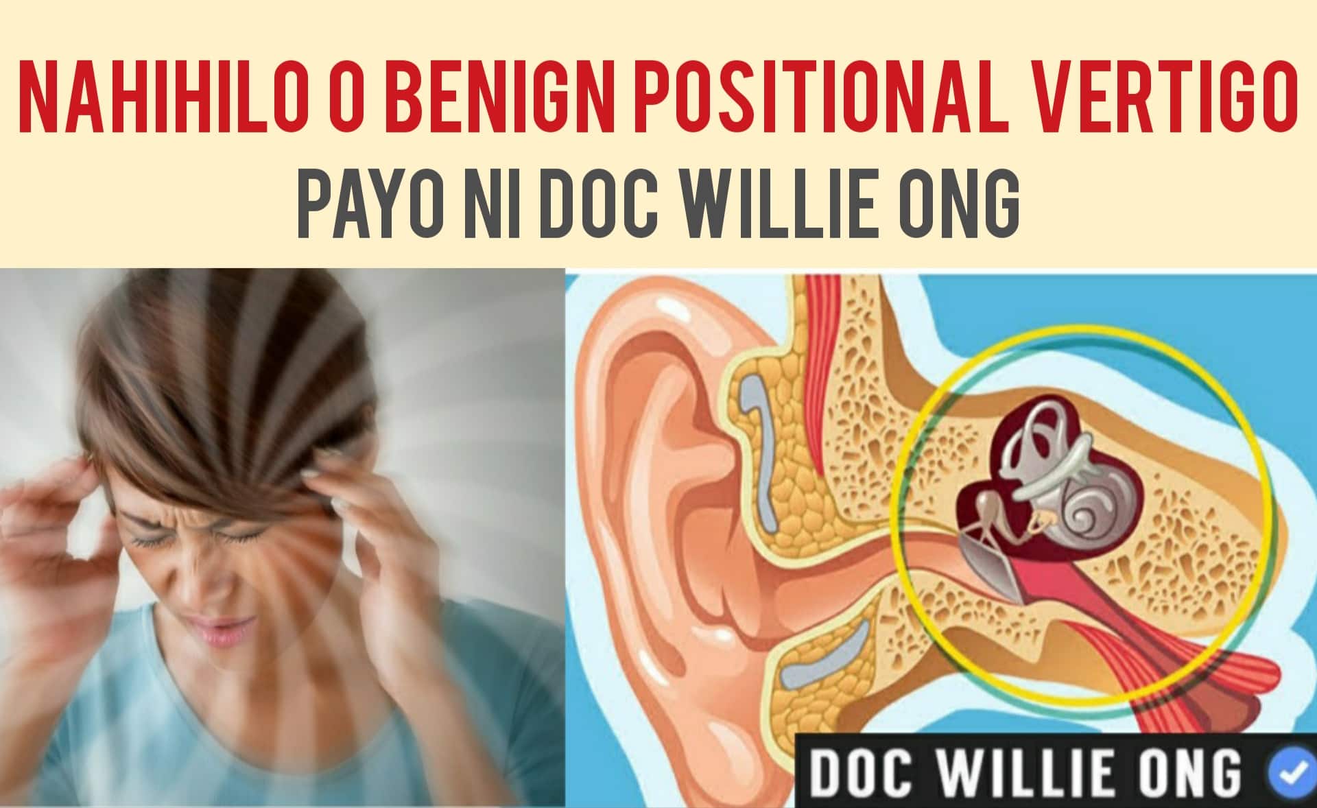 Doc - Nahihilo o Benign Positional Vertigo By Doc Willie Ong Maraming ...