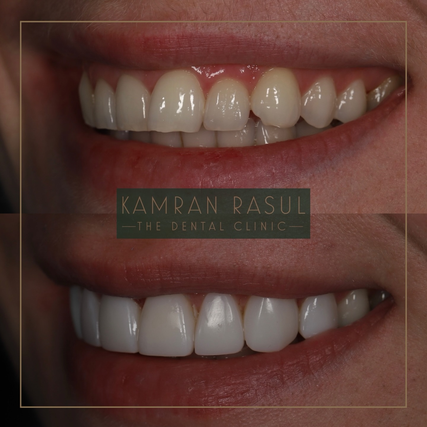 Kamran Rasul | Liverpool