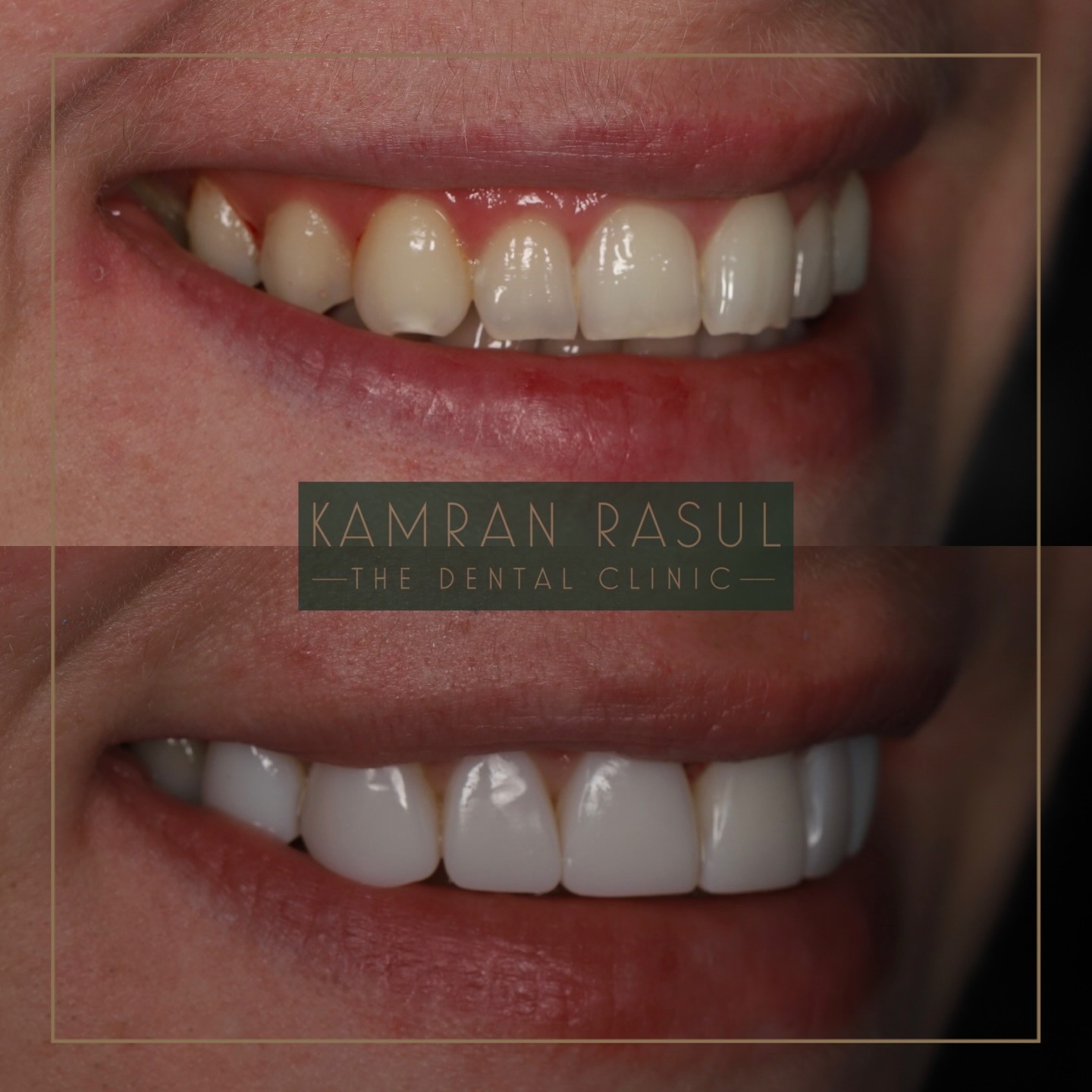 Kamran Rasul | Liverpool