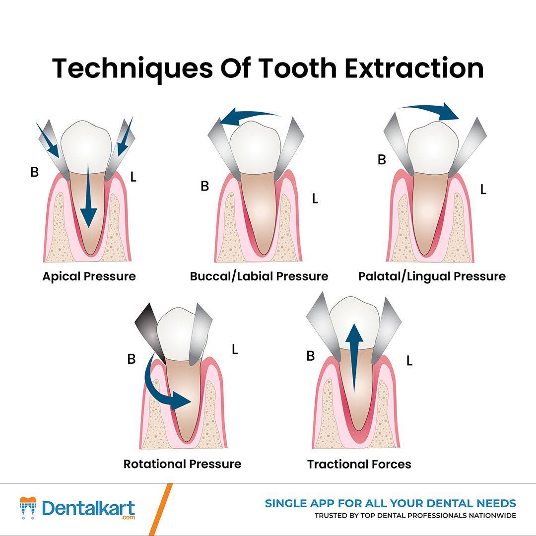 Dental Clinical Skills Arcade - NDEB/ADC/NBDE/Bench Tests added a new ...