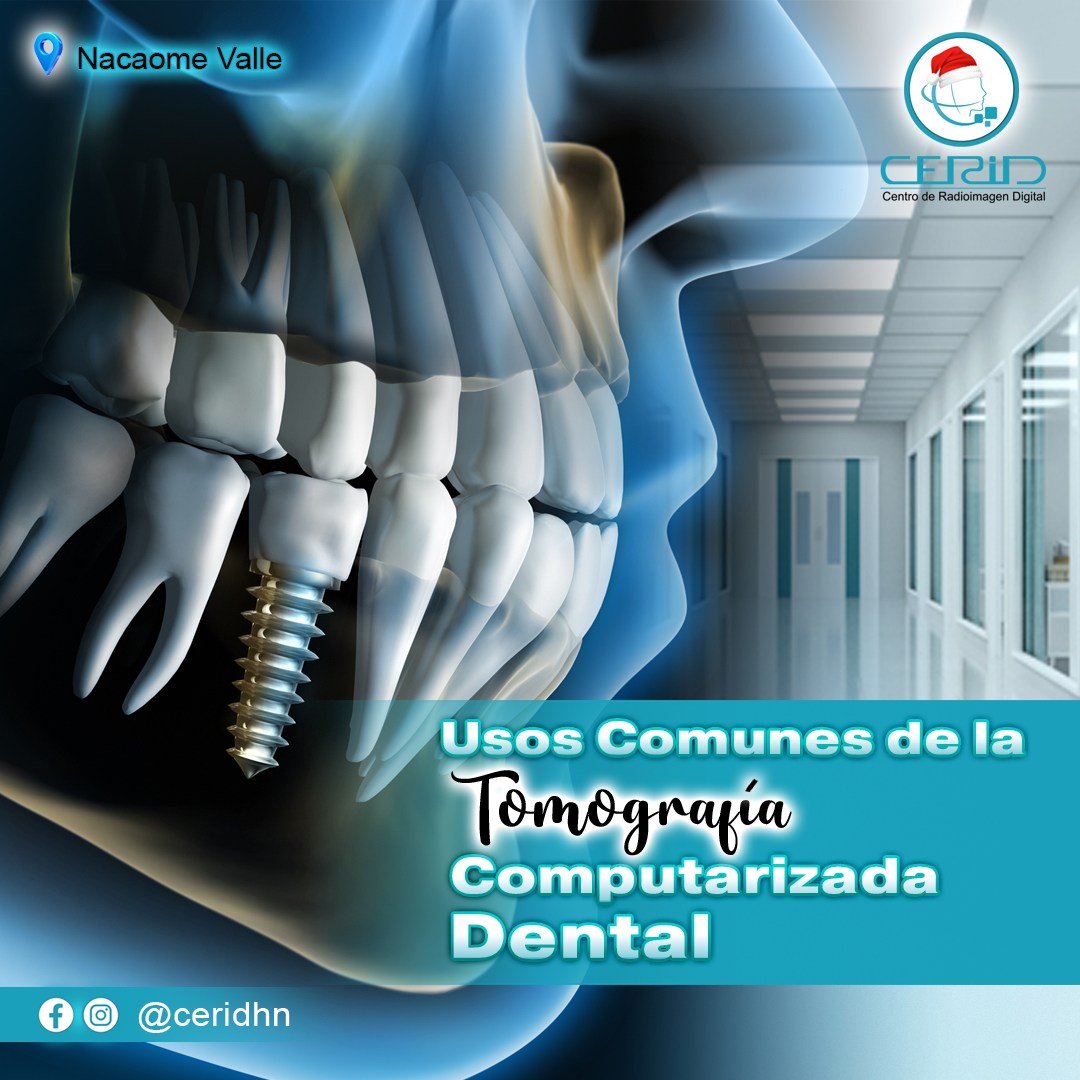 👨🏻‍⚕️¿Cuáles... - CERID - Centro de Radiología e Imagen Dental | Facebook