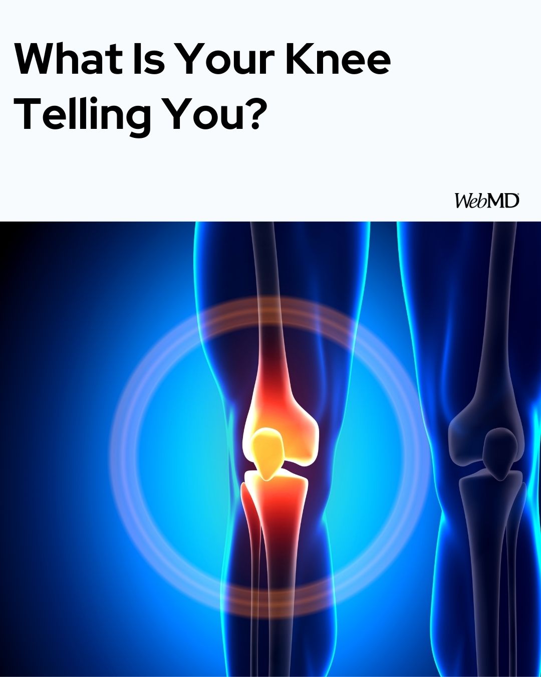 WebMD - When your knee creaks, pops, or cracks, is it a sign of an ...