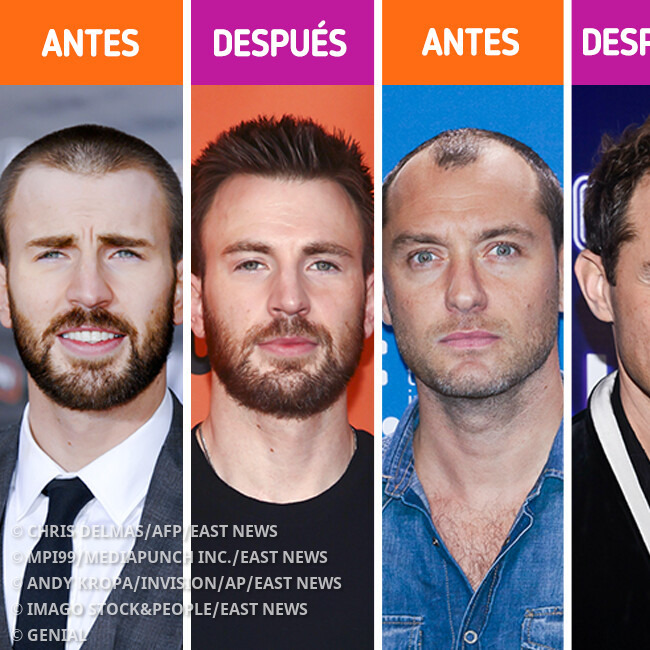 Genial - Cómo lucían 12 hombres famosos antes de someterse... | Facebook