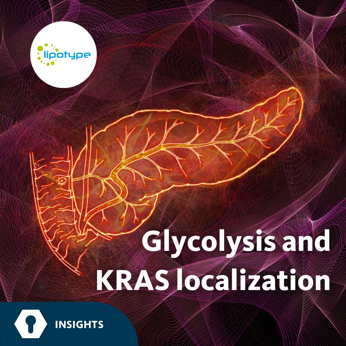 Lipotype - Glycolysis and KRAS localization --- Aerobic... | Facebook