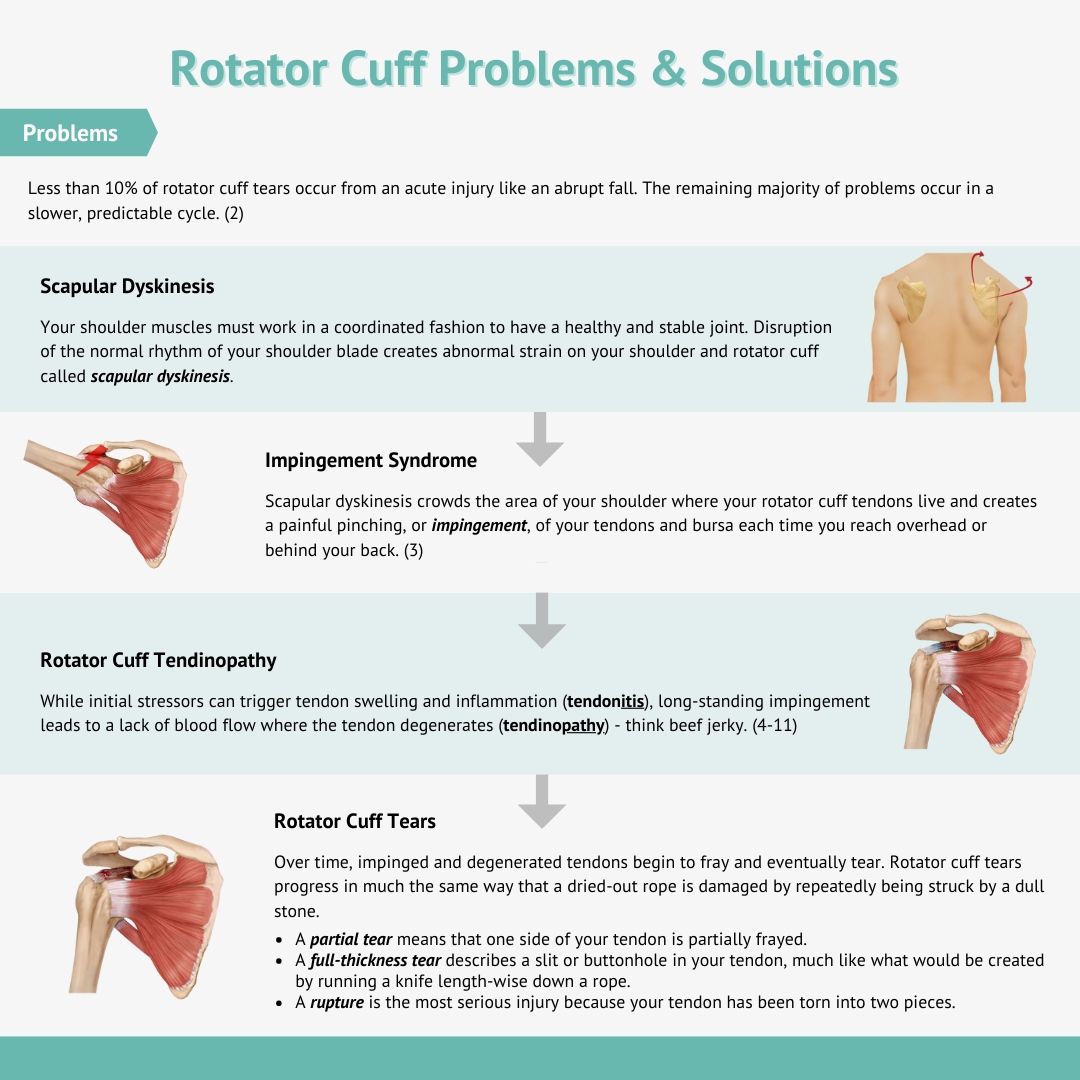 Advanced - Rotator cuff injuries are one of the most common causes of ...