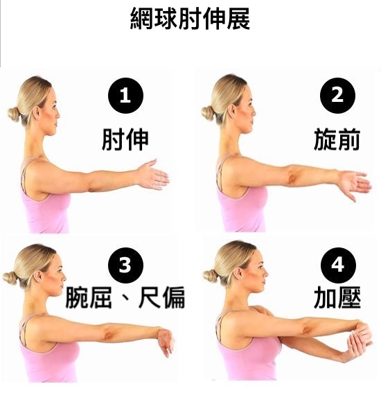 物理治療治什麼 1 網球肘 Physiomotion Lab 動作實驗室 Facebook