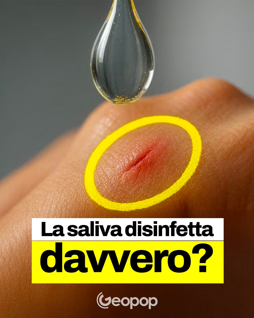 geopop-vero-che-la-saliva-disinfetta-le-ferite-la-facebook