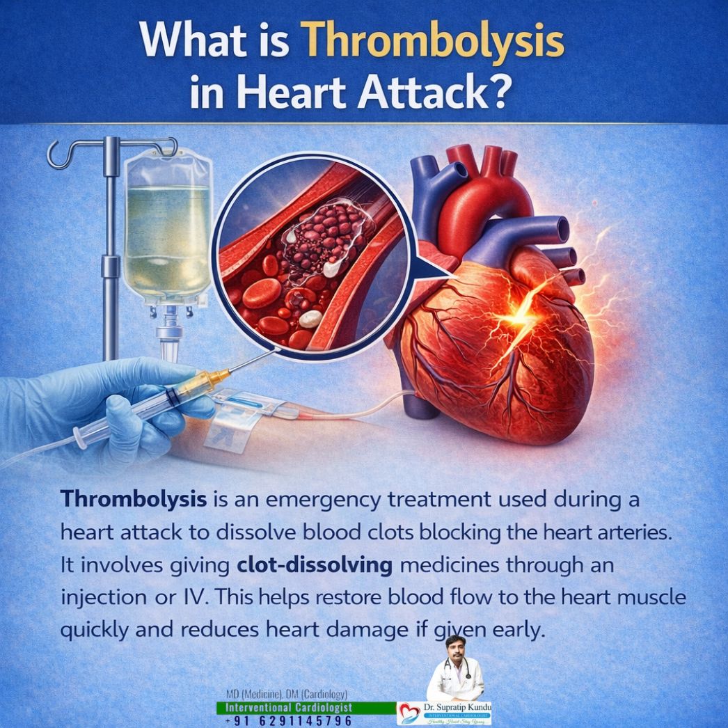 💉 Thrombolysis is an... - Dr. Supratip kundu cardiologist | Facebook