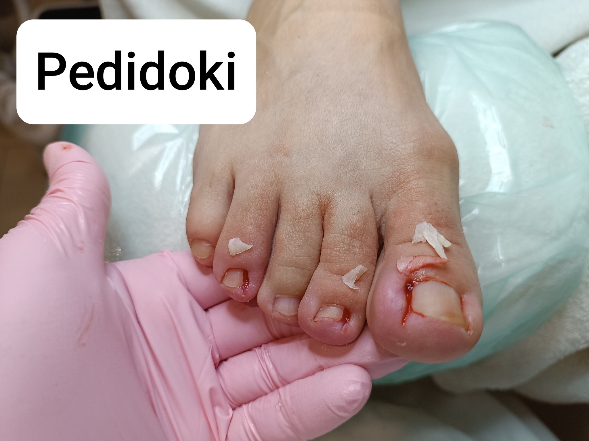 pedidoki-speci-lis-l-b-pol-mester-kipr-b-ltuk-szem-lcskezel-s
