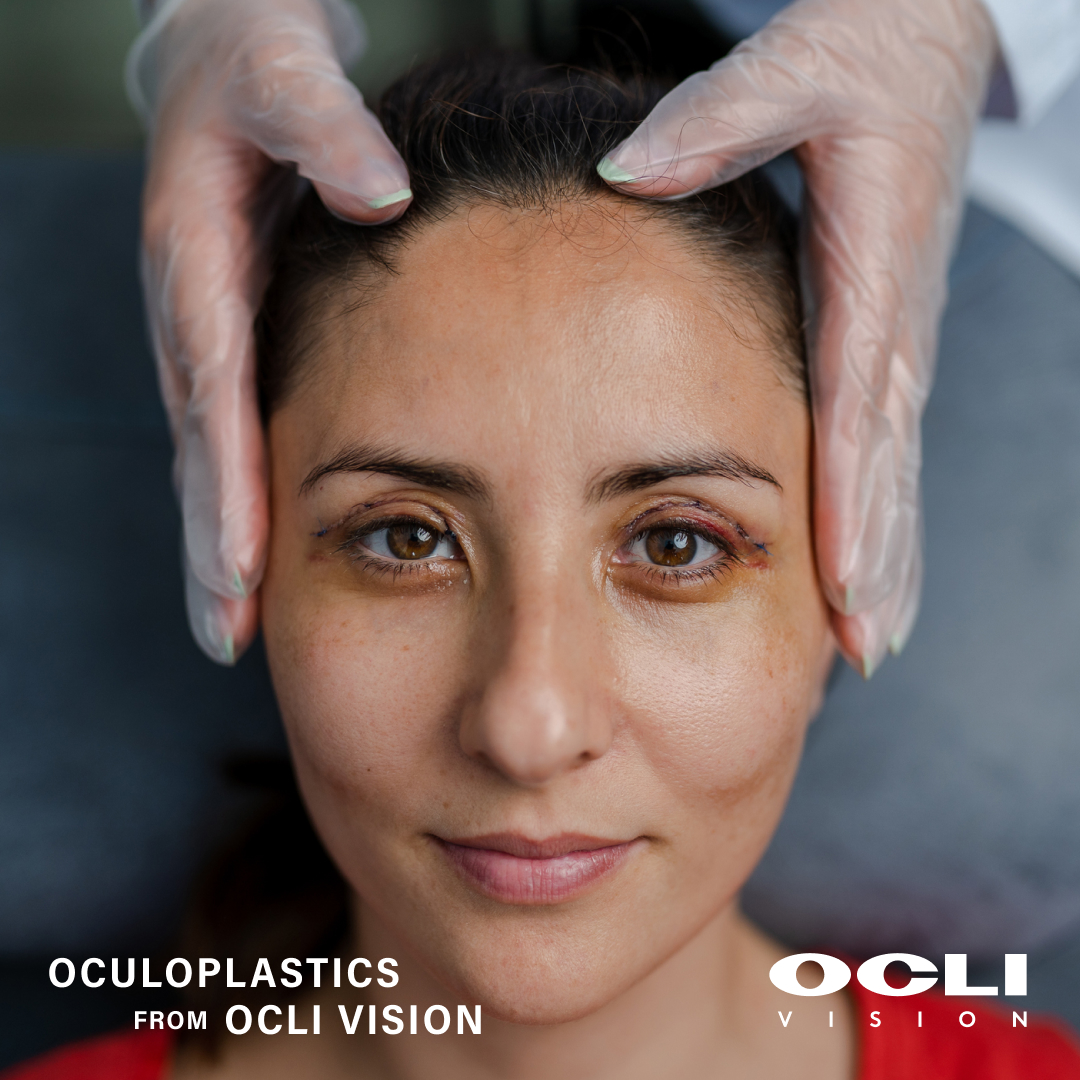 OCLI Vision - Oculoplastics at OCLI Vision Beyond... | Facebook