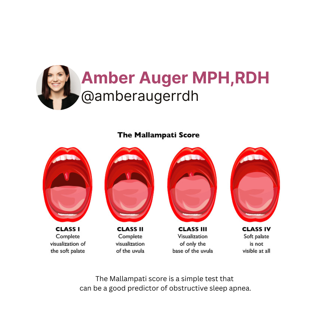 Amber - The Mallampati classification relates tongue size to pharyngeal ...