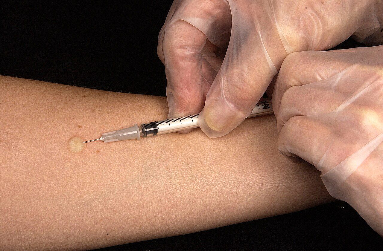 size of needle for b12 intramuscular injection 🛎️ The appropriate gauge intradermal is: A. 20G B. 22G C. 25G D. 26G Antifungal Dose:50 mg Draw up a vitamin