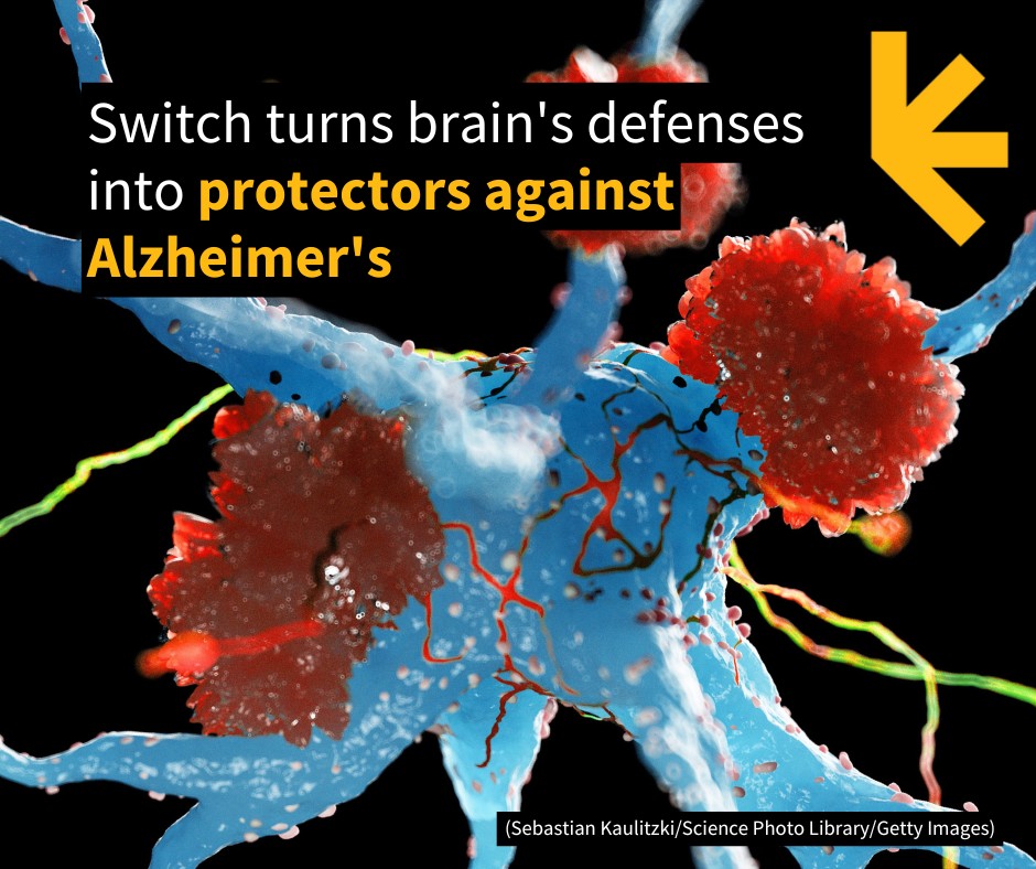 ScienceAlert - Immune cells in the brain called microglia can become ...