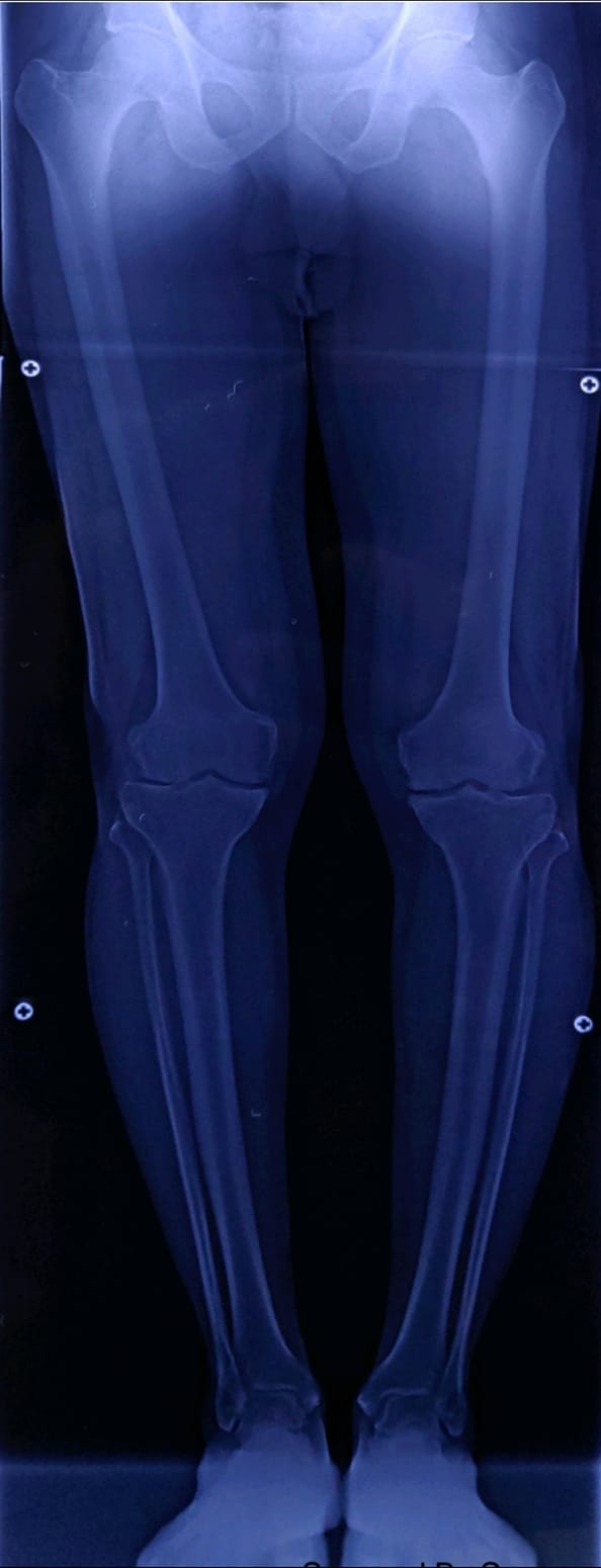 Bilateral... - Agrawal Advanced Imaging Center- AAIC, Akola | Facebook