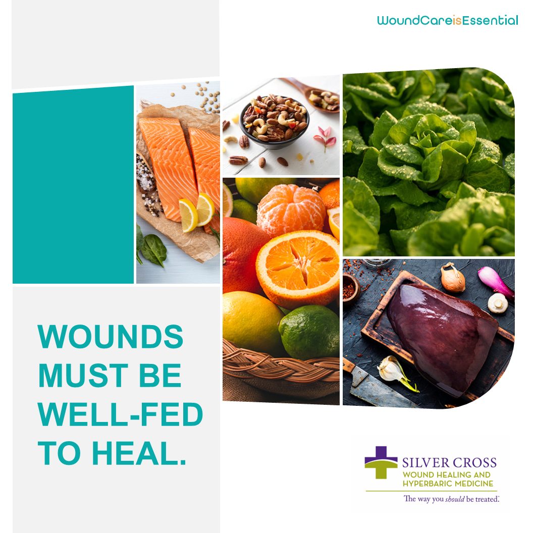 terry naturally clinical glutathione reviews During wound healing, your body is busy adding new tissue, replacing fluids lost in wound drainage and fighting infection. No wonder it needs a little extra nutrition to get it all done! Homeostasis and feedback loops كريم عناية متكاملة لتفتيح البشرة Number of Disposables:25 Disposables | $3.80 per (Previously $5.25 Per)
