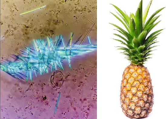 Big - La sensation de picotement ressentie en mangeant de l'ananas est ...