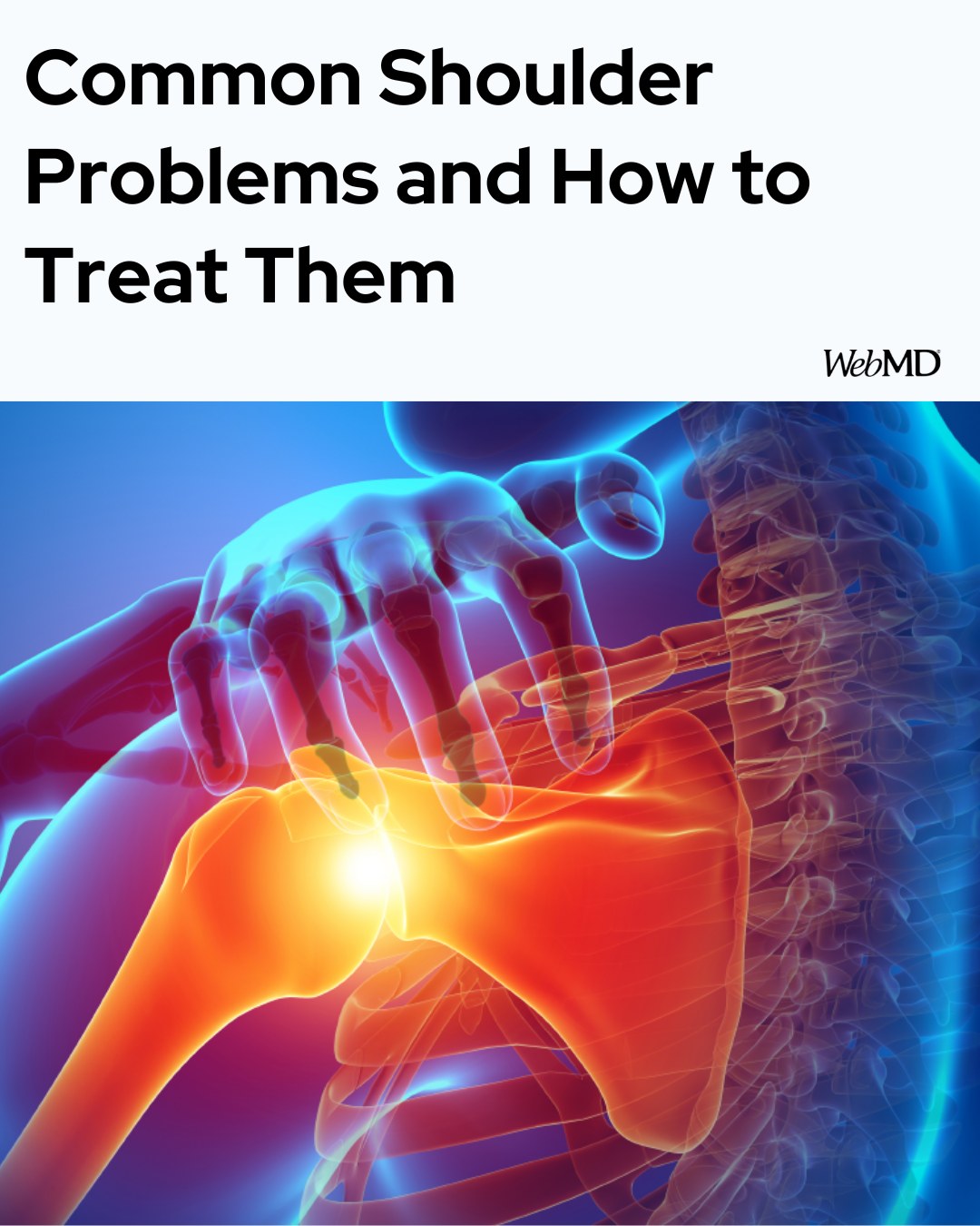 WebMD - Shoulder pain can have many causes. You might injure it in a ...