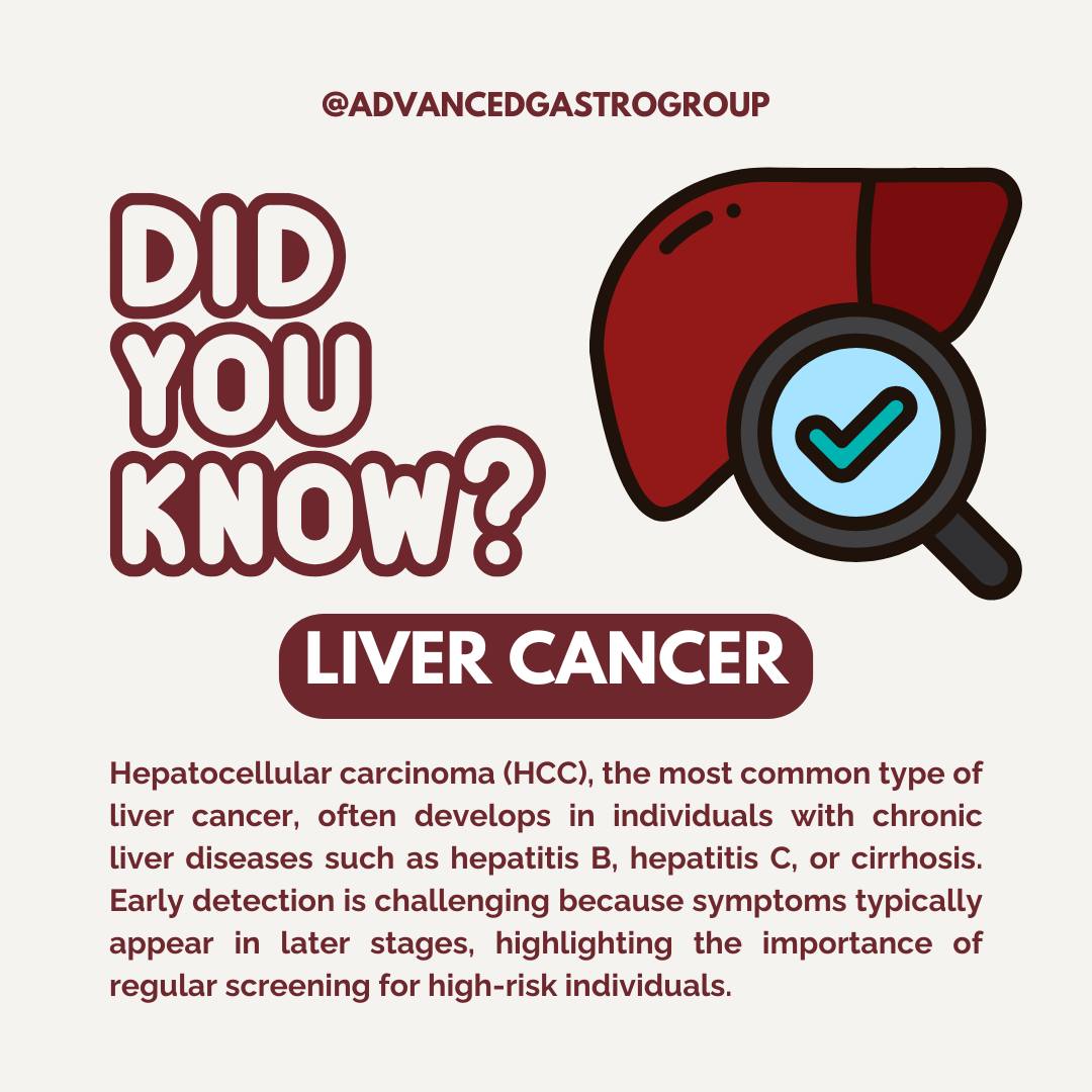 Advanced - Hepatocellular carcinoma (HCC) is the most common form of ...