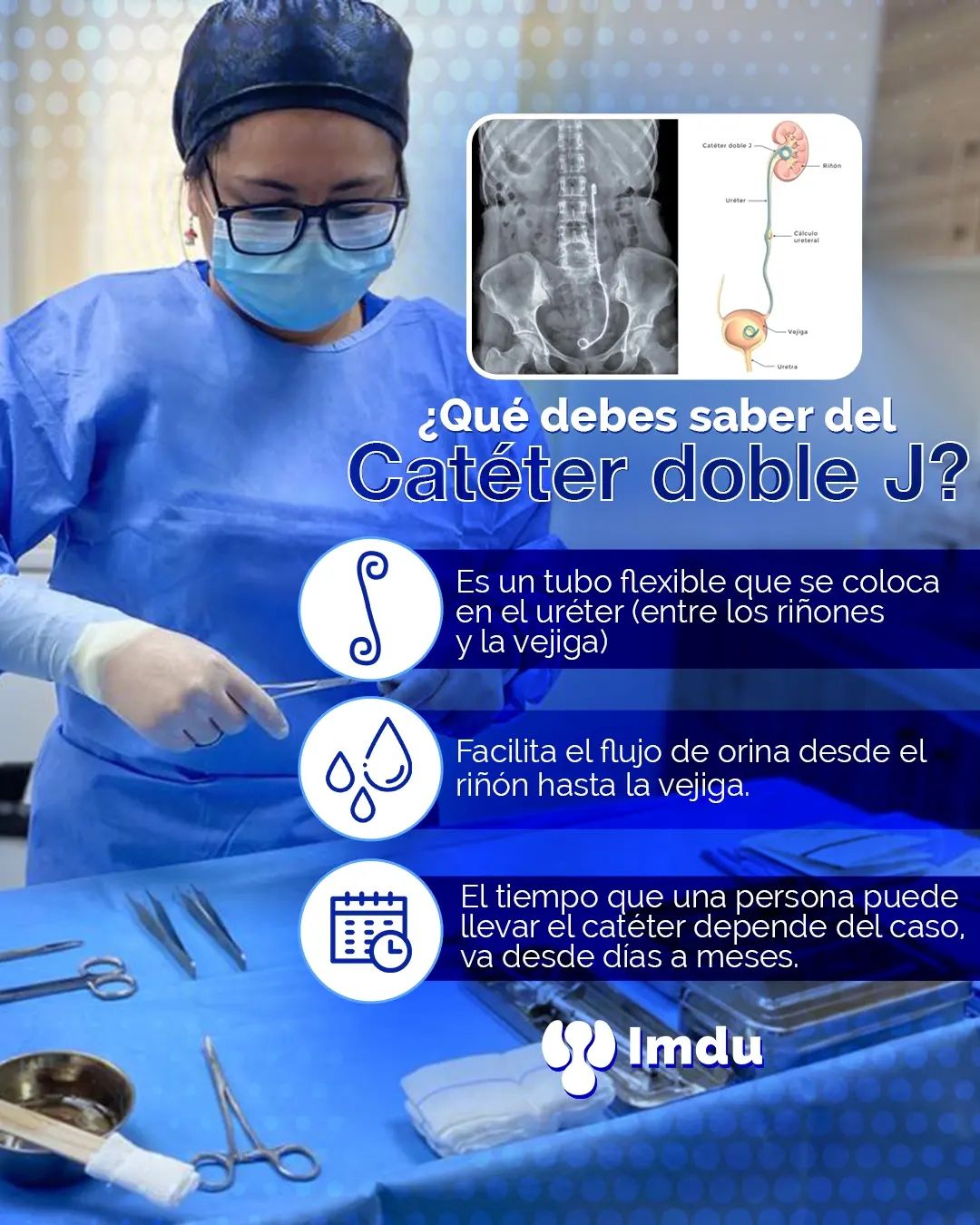 IMDU - El catéter doble J es un tubo hueco y flexible, mide entre 26 y ...