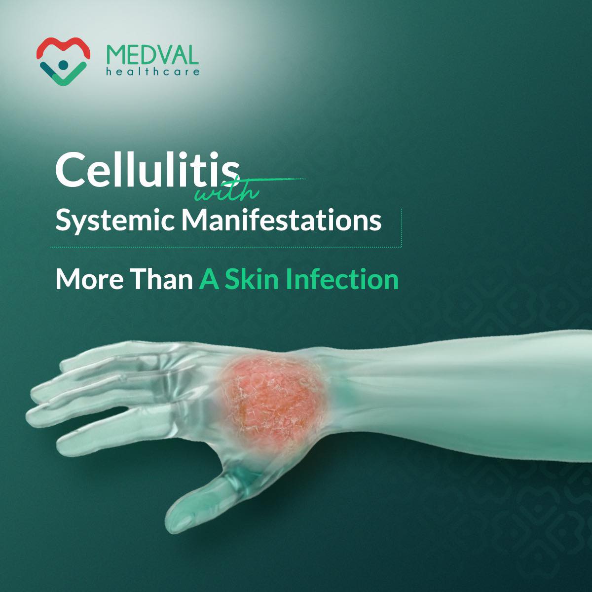 Medval - ميدفال وكيل ميندراي .. بداية جديدة ونعدكم بأن تكون مختلفة ...