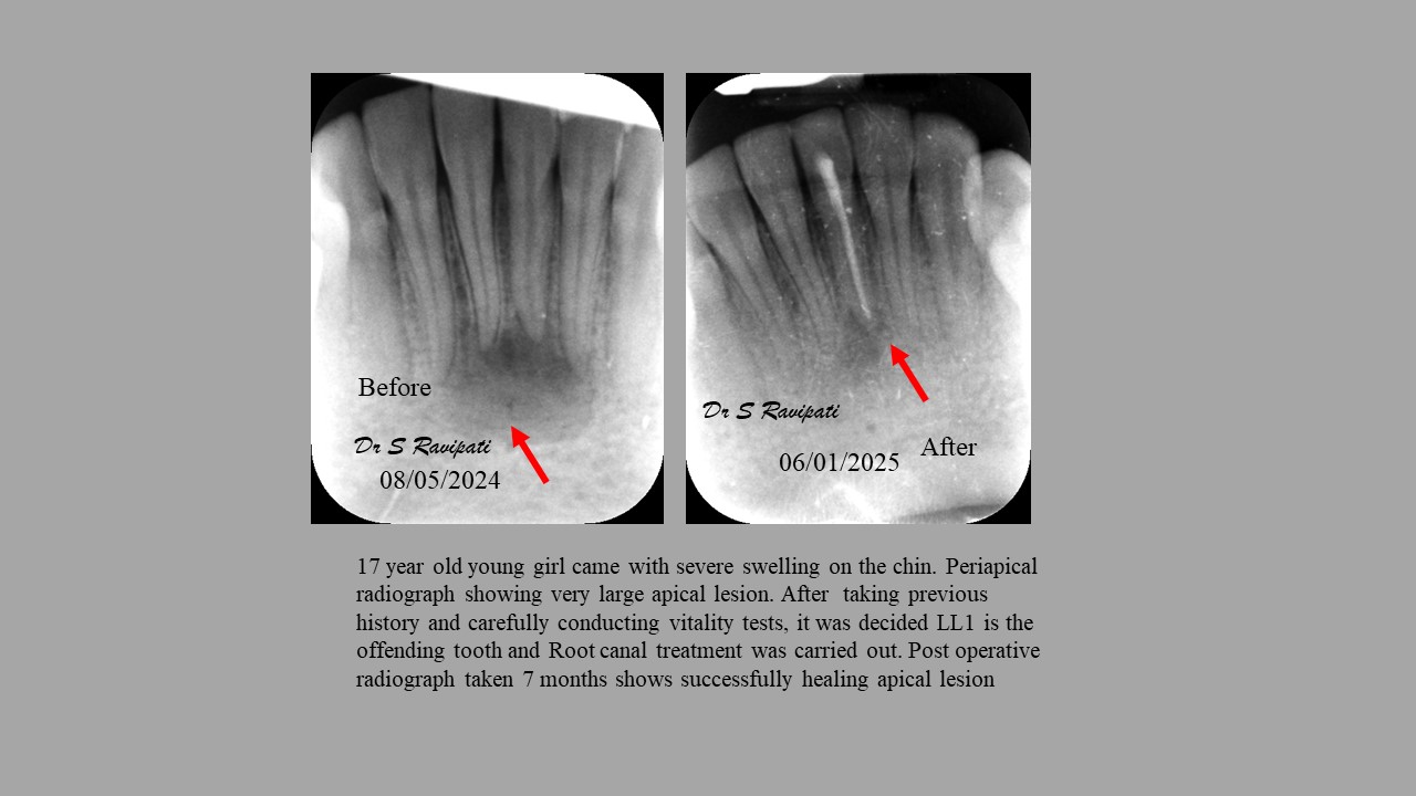 Claremont - 17 year old young girl came with severe swelling on the ...